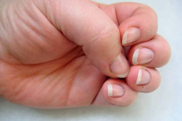 care for nails after removing acrylics